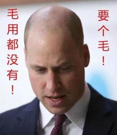 秃顶吃瓜,揭秘娱乐圈的“头顶秘密”